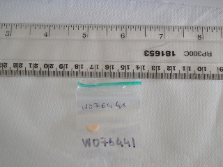 W076441